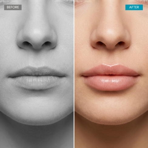 Before and After Results